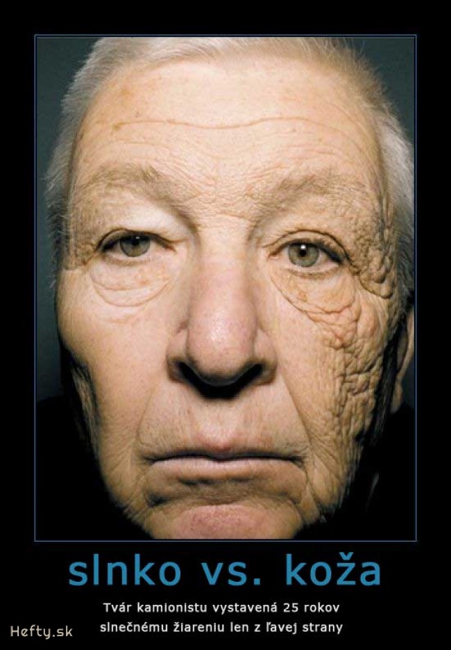 slnko vs. koža